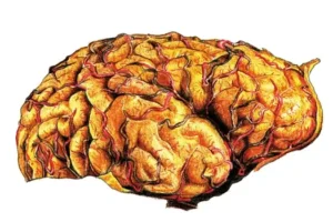 Brain Coverings