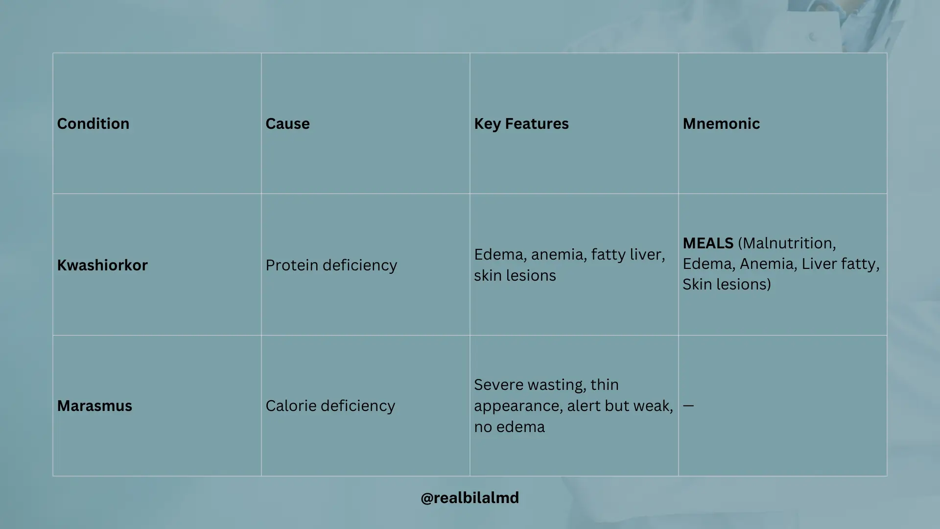 Table showing Kwashiorkor and Marasmus, including cause, features, and mnemonic.