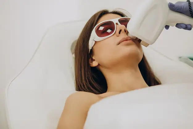 A dermatologist performing laser hair removal on a woman’s upper lip while she wears protective eyewear — showing how laser treatment heat can sometimes cause temporary light or dark skin patches depending on skin tone and laser settings.