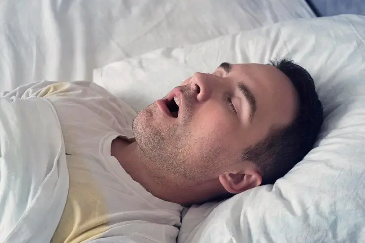 Man sleeping with his mouth open due to mouth breathing at night — illustrating causes like nasal congestion, snoring, or sleep apnea that affect nighttime breathing.