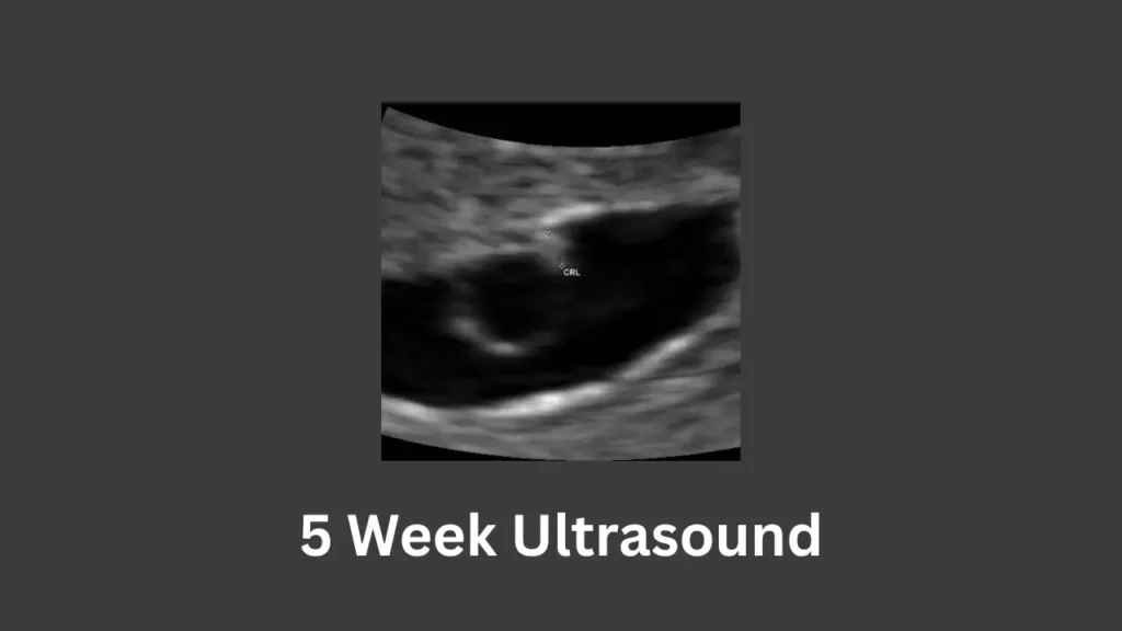 Early pregnancy ultrasound at 5 weeks showing a developing gestational sac with a visible yolk sac and early embryo measurement (CRL), labeled as 5 Week Ultrasound.