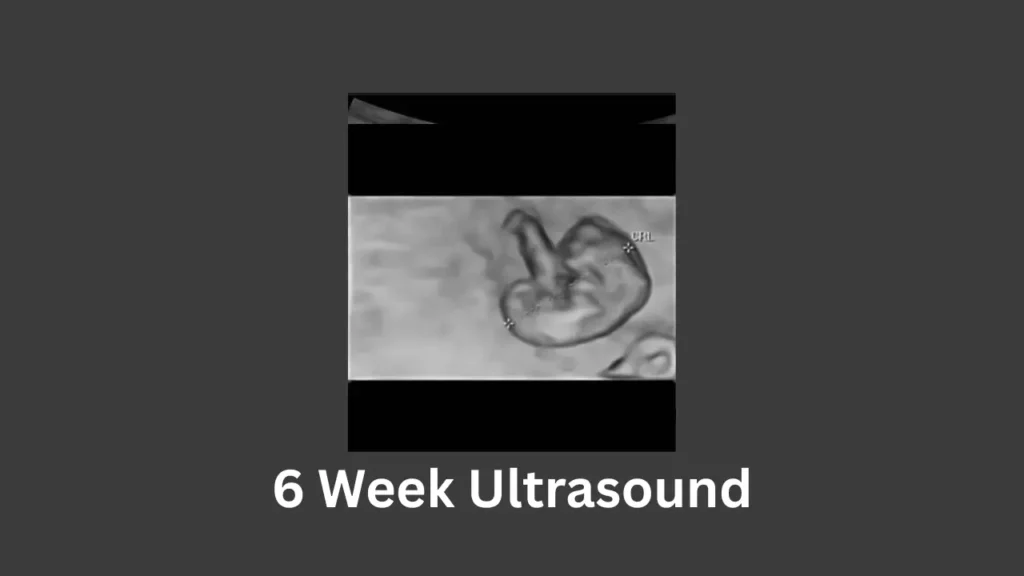 6 week pregnancy ultrasound image showing a small developing embryo with crown-rump length (CRL) measurement visible inside the gestational sac.