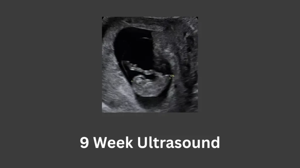 9 week pregnancy ultrasound showing a clearly visible embryo with head and body structure, measured by crown-rump length (CRL) inside the uterus